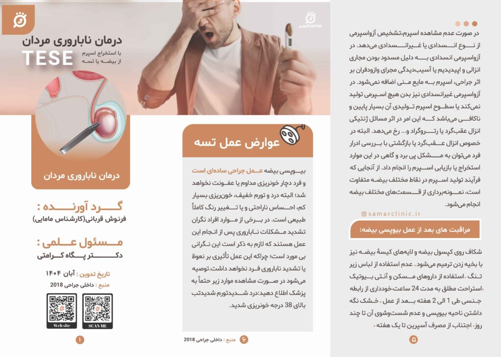 تسه