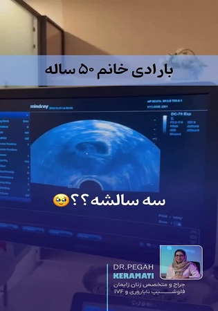 بارداری دو قلویی